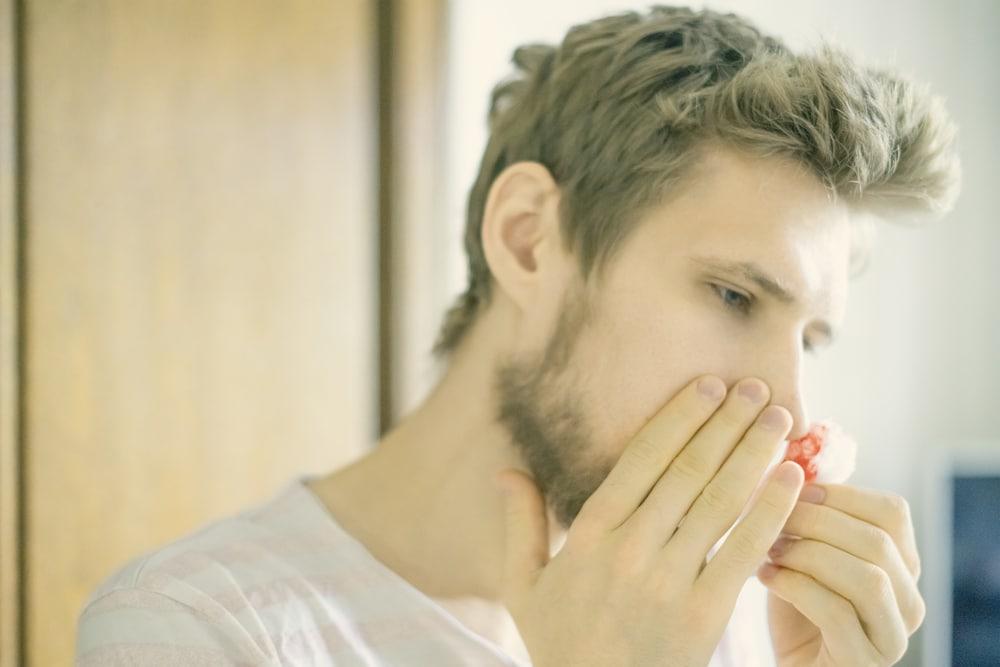 Junger Mann hat Nasenbluten als Symbolbild für den Ratgeber: Nasenbluten stoppen