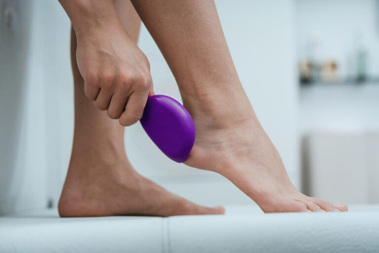 Eine Person entfernt mit einer violetten Hornhautfeile die Hornhaut an der Ferse.