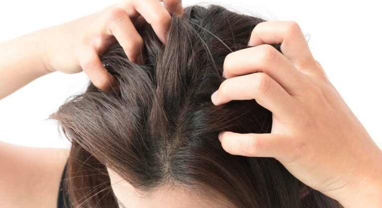 Frau fährt sich mit den Fingern durch die Haare als Symbolbild für den Ratgeber: Tipps gegen trockene Kopfhaut